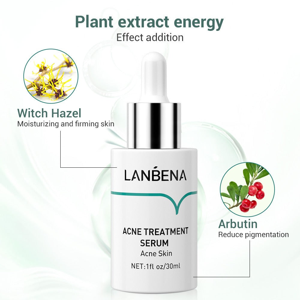 ACNE TREATMENT SERUM - LANBENA - (30ml or 15ml) - Yo'rTotal Beauty