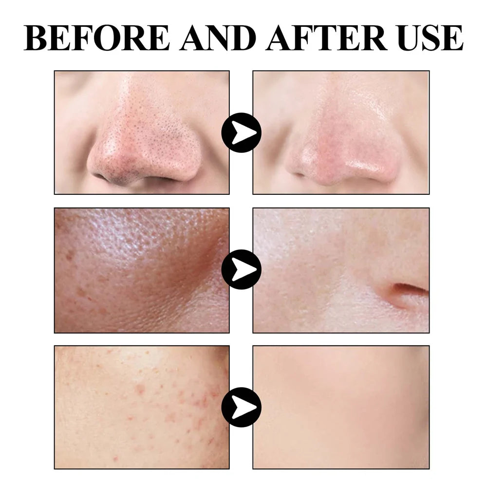 Skincare - West & Month Blackhead Remove Solid Mud Film Refreshing Skin Cleaning Face Mask Moisturize Control Oil Shrink Pores Skin Care - Yo'rTotal Beauty