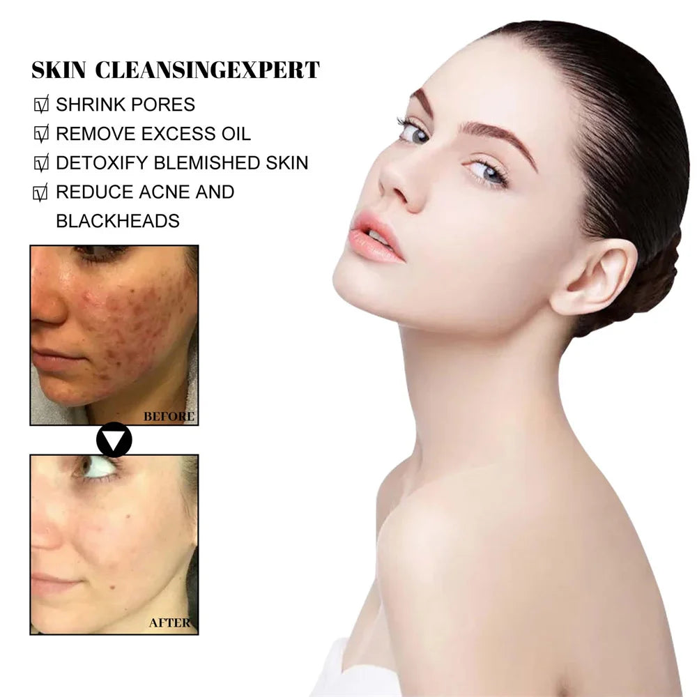 Skincare - West & Month Blackhead Remove Solid Mud Film Refreshing Skin Cleaning Face Mask Moisturize Control Oil Shrink Pores Skin Care - Yo'rTotal Beauty