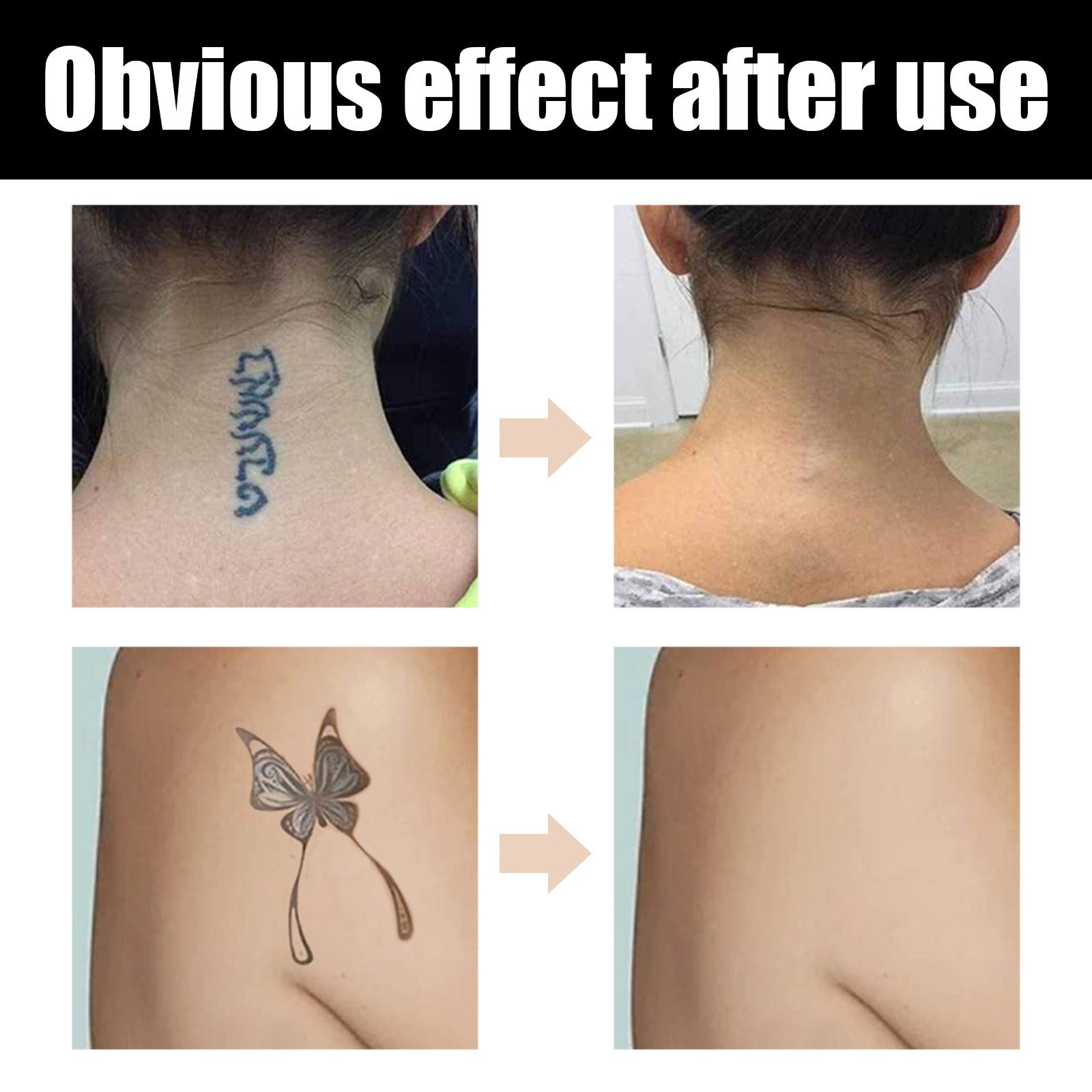 EELHOE Tattoo Concealer - waterproof, cover tattoo, scar, birthmark cover - invisible two-color concealer - Yo'rTotal Beauty