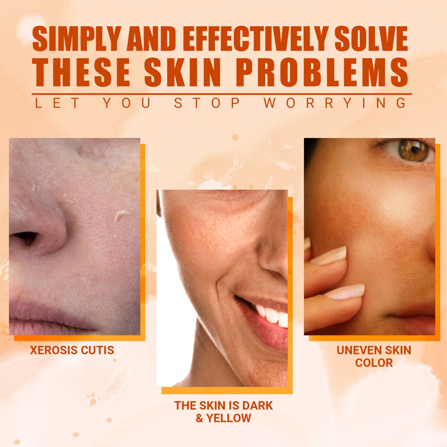 Vitamin C Moisturizing Spray Hydrates And Moisturizes Skin, Lightening Acne Spots And Whitening Spray - Yo'rTotal Beauty