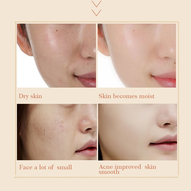 EFERO Anti Aging Snail Essence Face Cream Brightening Snail Cream, Moist Nourishing,  Face  Lifting, anti wrinkle Cream - Yo'rTotal Beauty