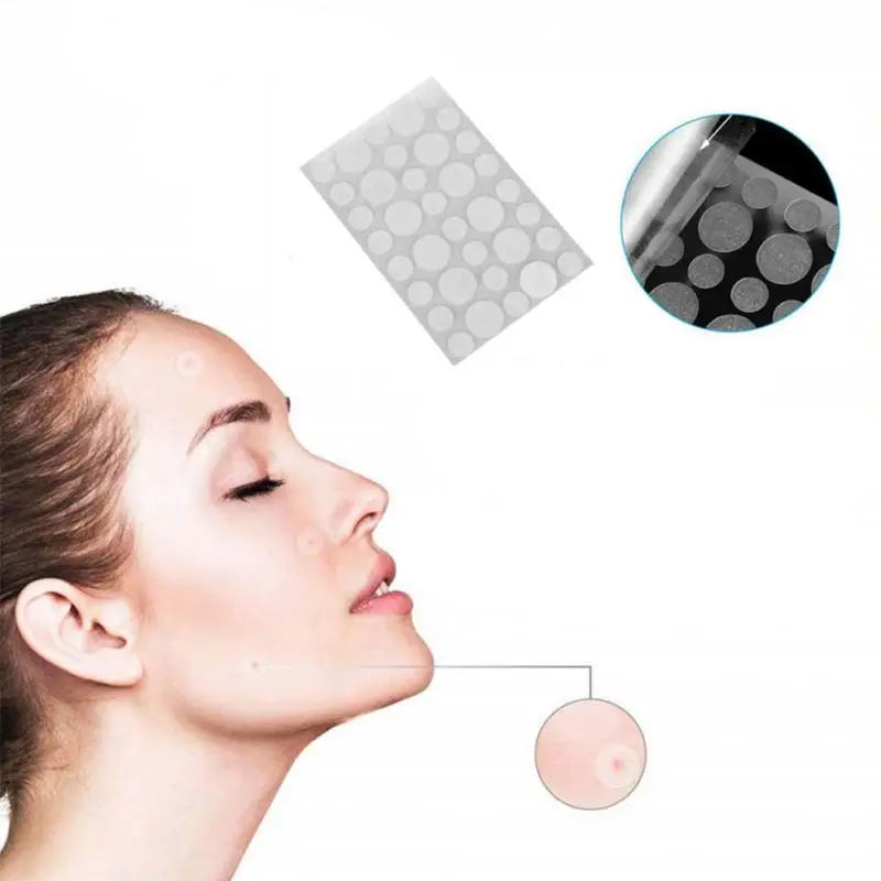 36pcs (per set) Pimple Remover -  Master Patch Acne Treatment - INVISIBLE ACNE PATCH- Face Skin Care Tools - Yo'rTotal Beauty